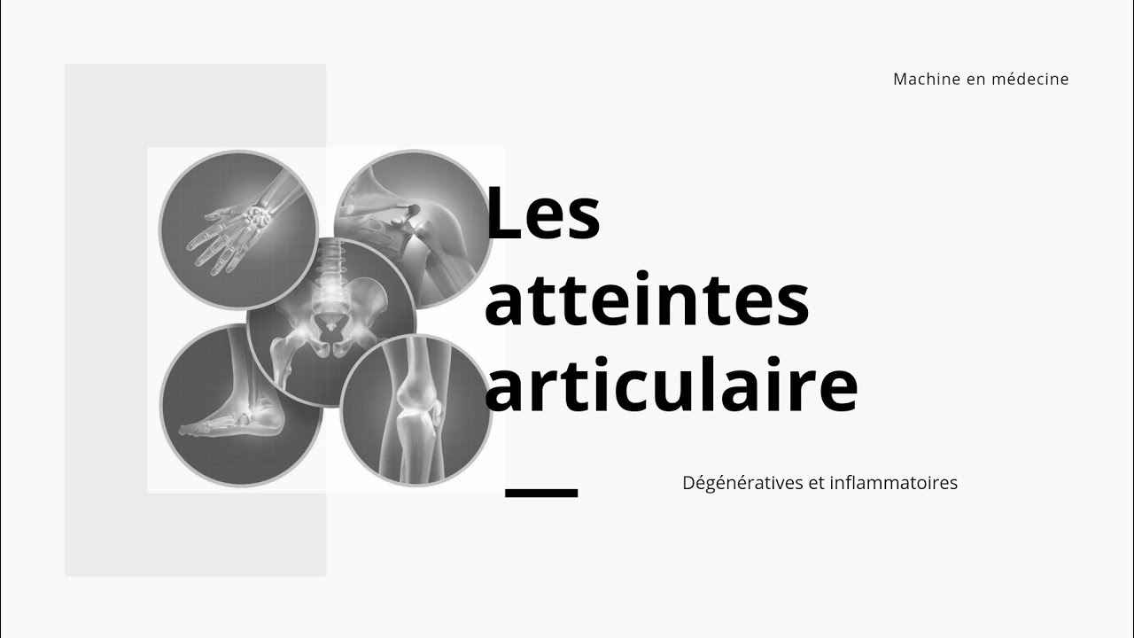 les atteintes articulaires #mpr
