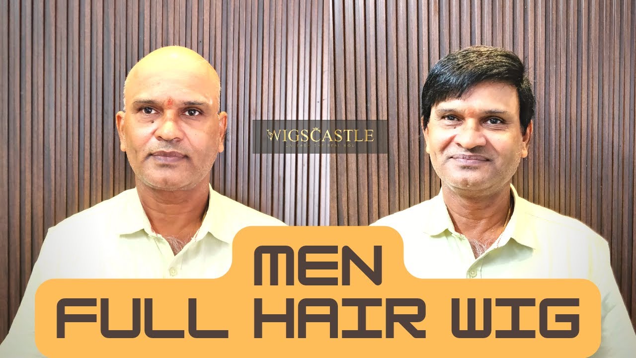 Full Hair Wig For Men In Bangalore | Men Full Head Wig | Baldness | Alopecia | Full Bald Hair Wig |
