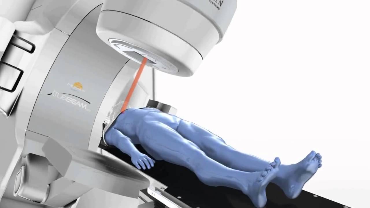 Truebeam STx Radiotherapy System