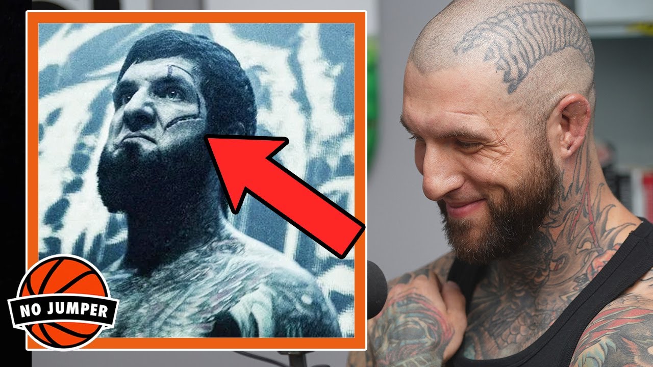 Alex Terrible Explains The Scar on his Face
