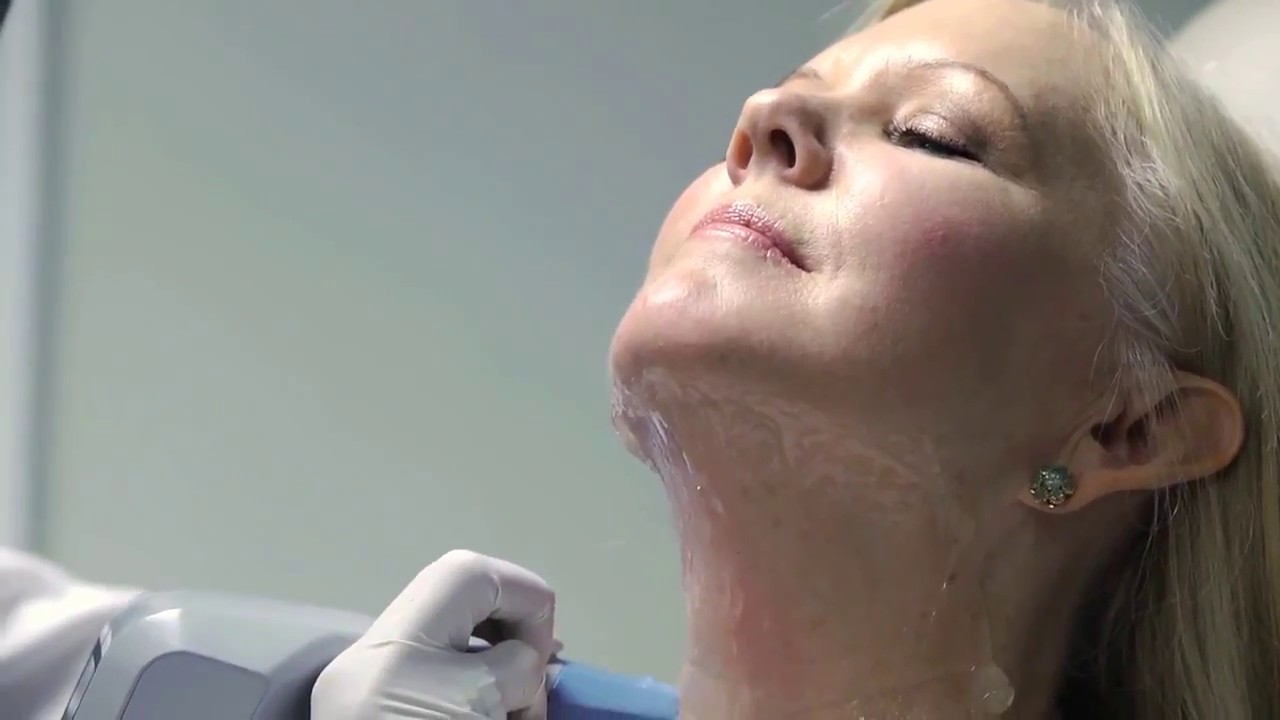Exilis Elite Laser Treatment by V Boutique Aesthetics - Dr V - V Boutique