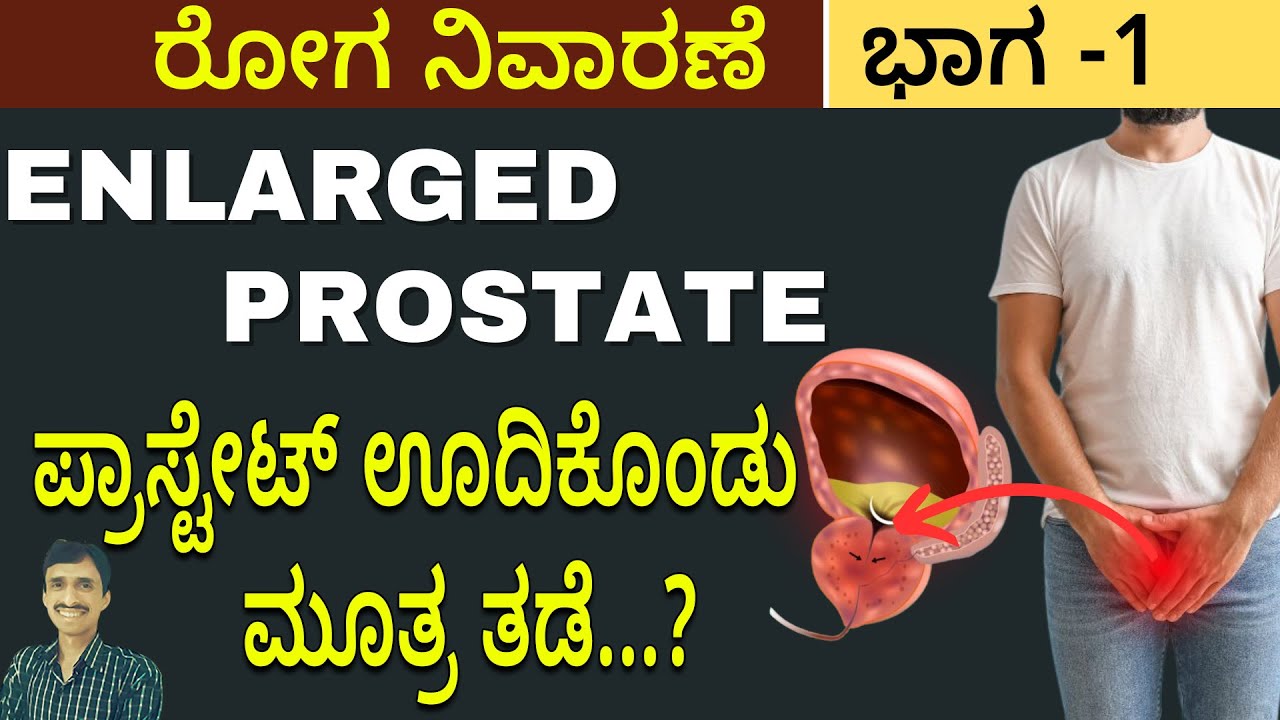 Prostate Enlargement Treatment | ಪ್ರಾಸ್ಟೇಟ್‍ ಗ್ರಂಥಿಯ ಸಮಸ್ಯೆ ಶಾಶ್ವತ ಪರಿಹಾರ..!