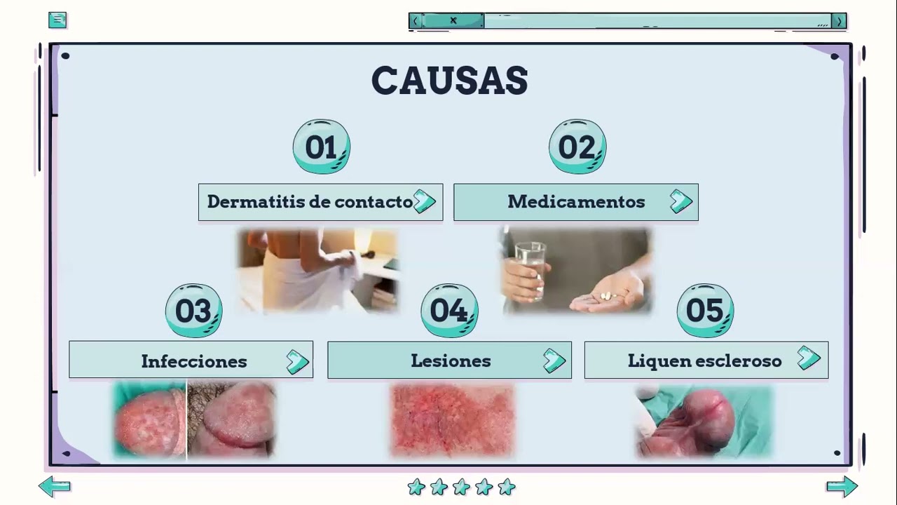 Qu&eacute; es la Balanitis?