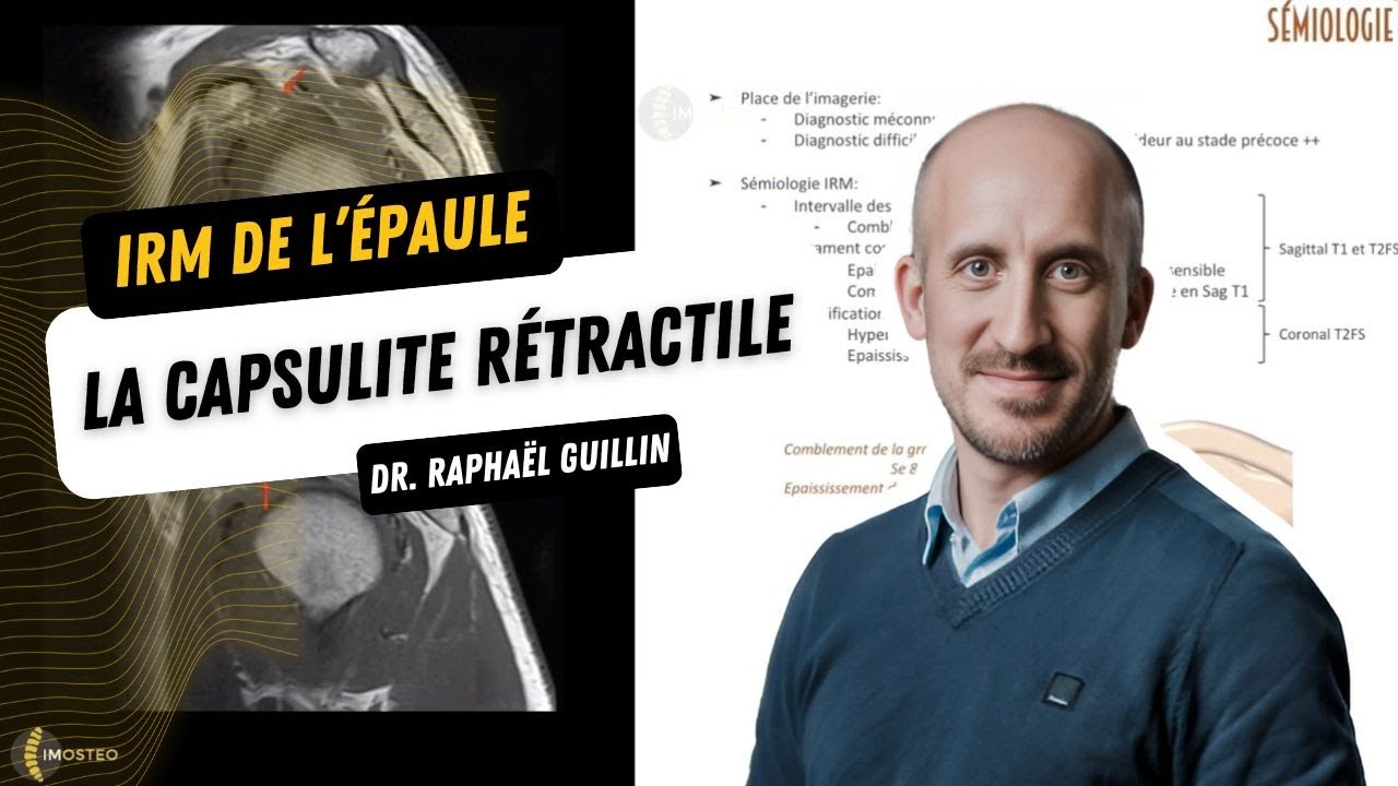 TUTORIEL IMOSTEO #27 : Sémiologie IRM de la capsulite rétractile
