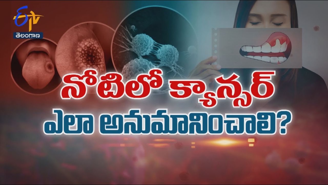 How to suspect Oral Cancer ? | Sukhibhava | 29th August 2023  | ETV Telangana