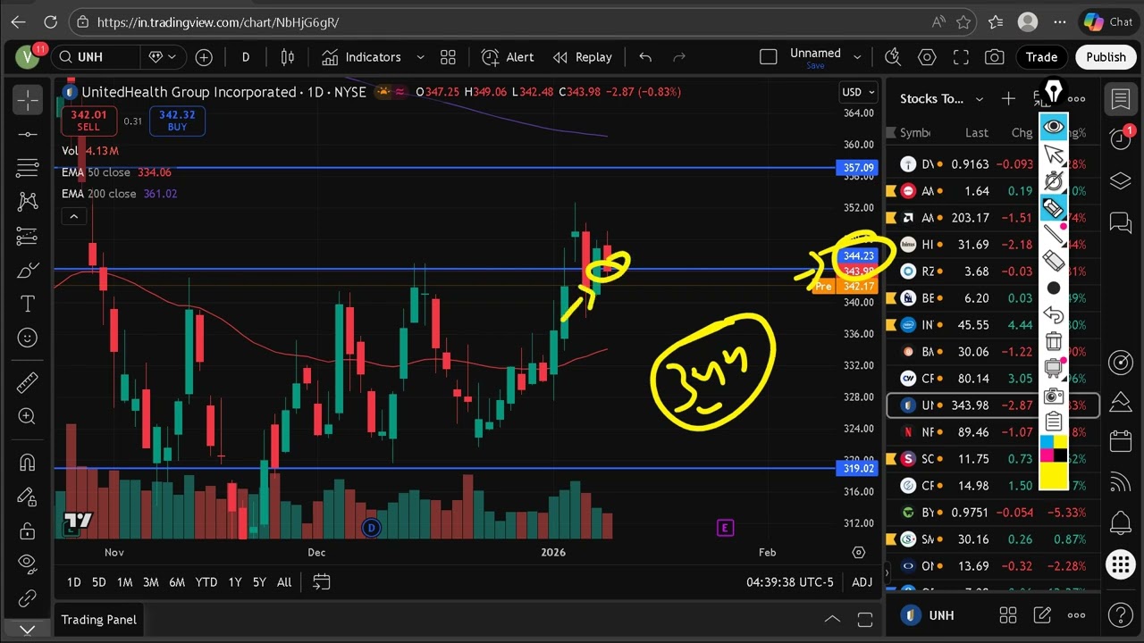 UNH Stock Prediction Today | UnitedHealth Group Breakout or Breakdown?