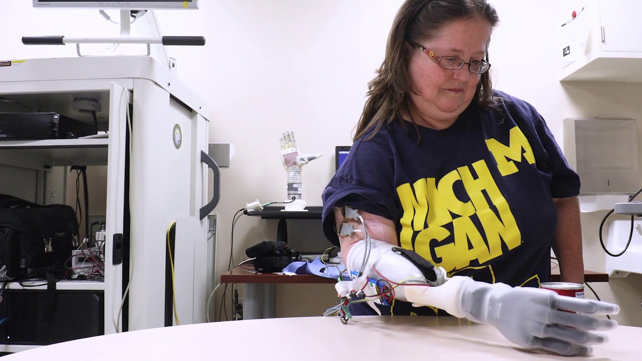 Regenerative peripheral nerve interface