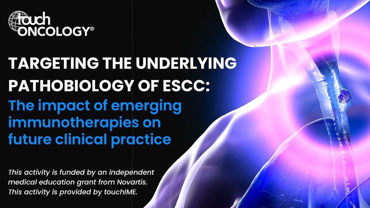 Targeting underlying pathobiology of ESCC: emerging immunotherapies on future clinical practice