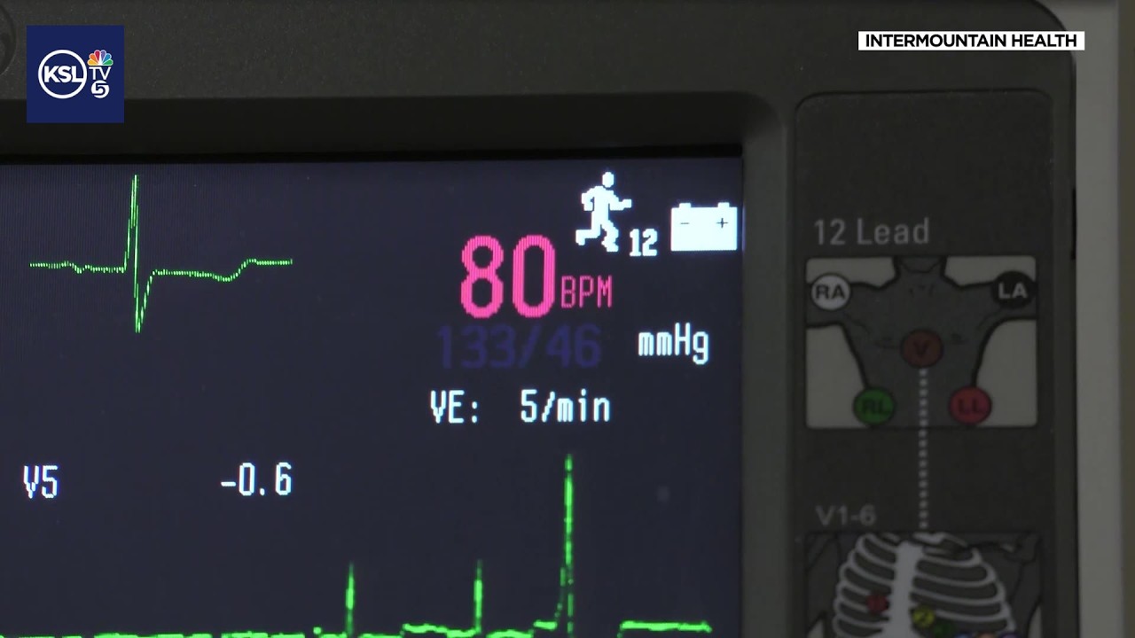 What you should know about irregular heartbeats, also known as arrhythmias