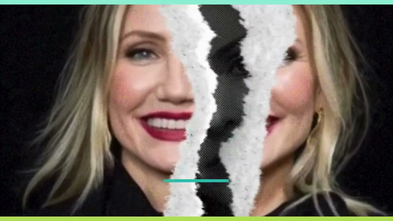 Botox preventivo y PRP: por qué empezar a tiempo sí hace la diferencia