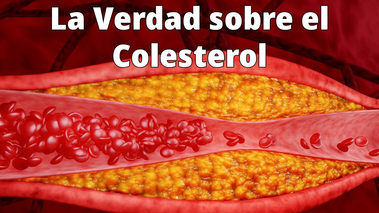 La Verdad sobre el Colesterol - Dr. Luis B&aacute;ez