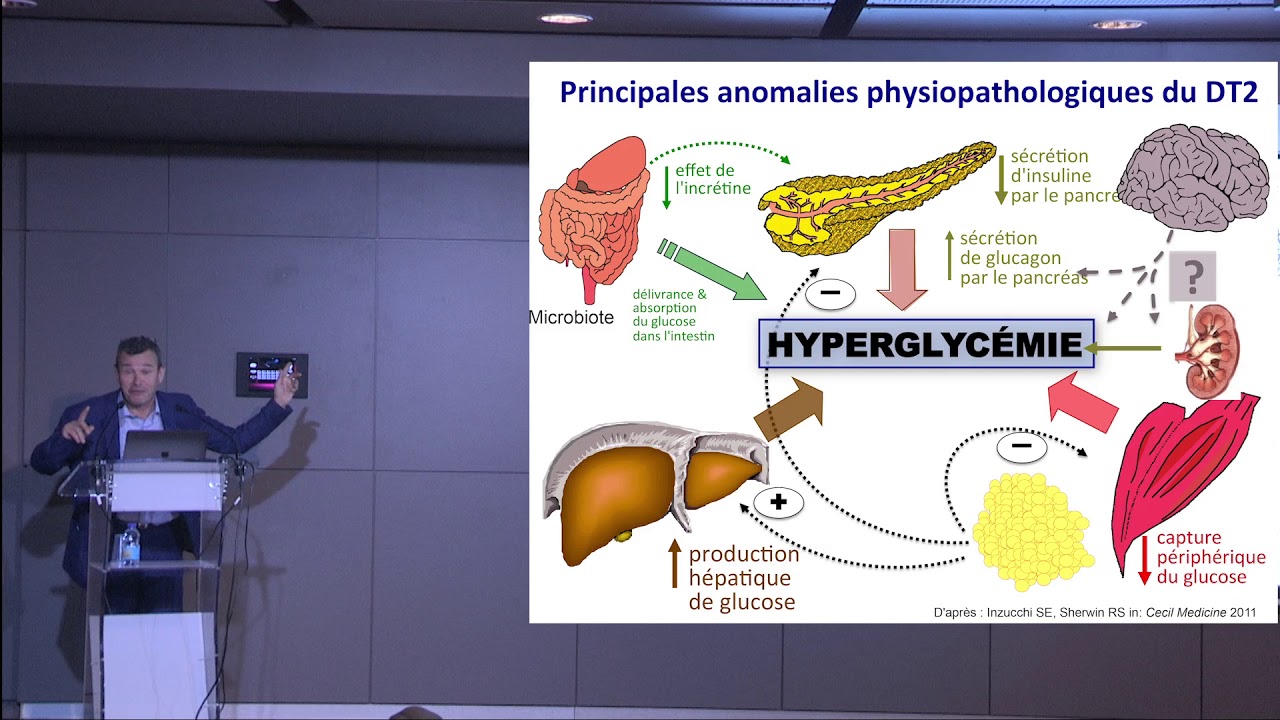 Diabète de type 2 – Pr. Jean-François Gautier
