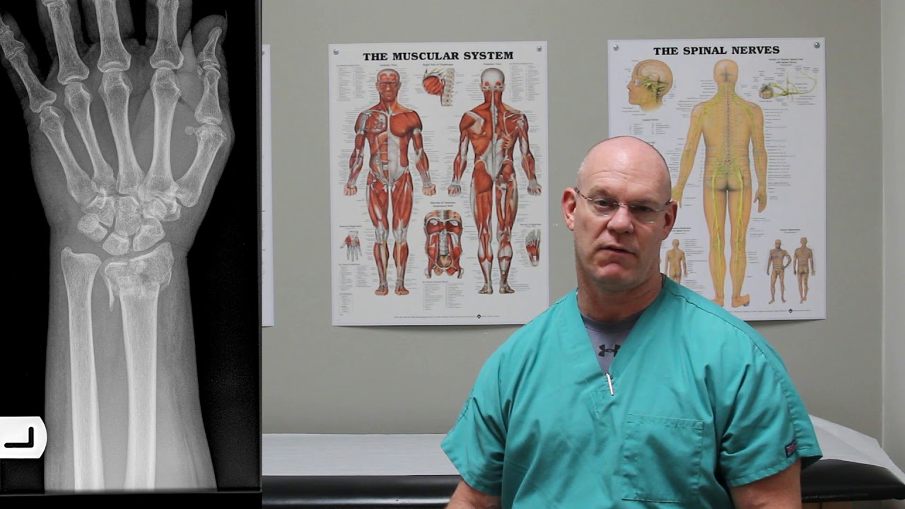 Forearm Fractures! | Fracture Friday Episode 23
