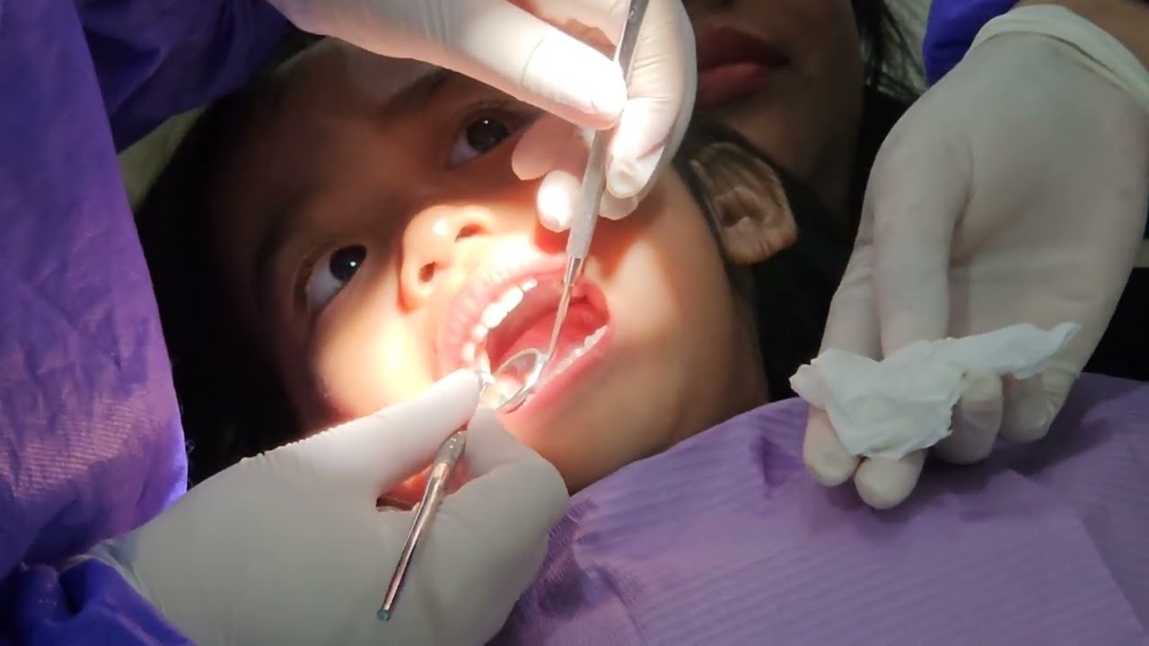 Adik Fely Restorasi Gigi🦷