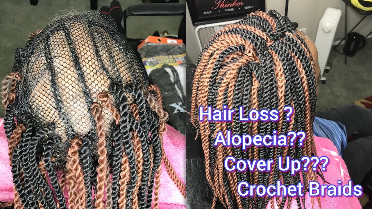 CROCHET BRAIDS ON A NET - WITH SOME ALOPECIA