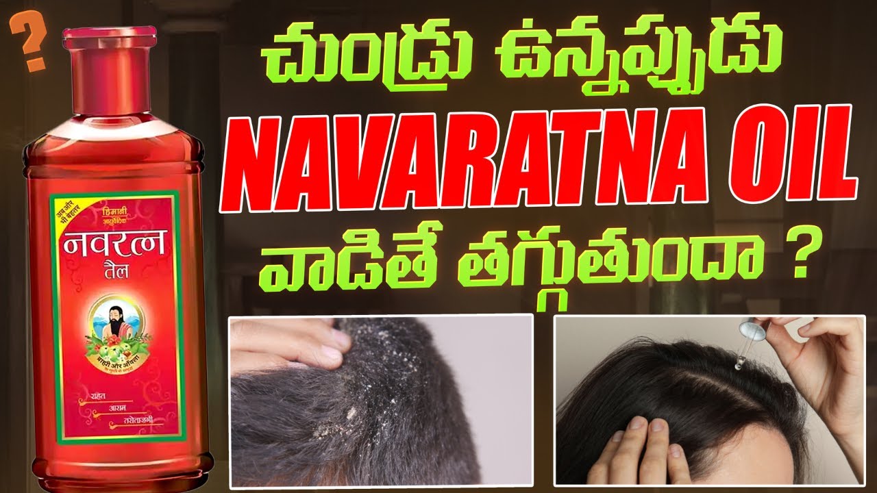 #AskDrJohnWatts | చుండ్రు ఉన్నప్పుడు NAVARATNA OIL వాడితే తగ్గుతుందా ? | Hair Specialist Explains