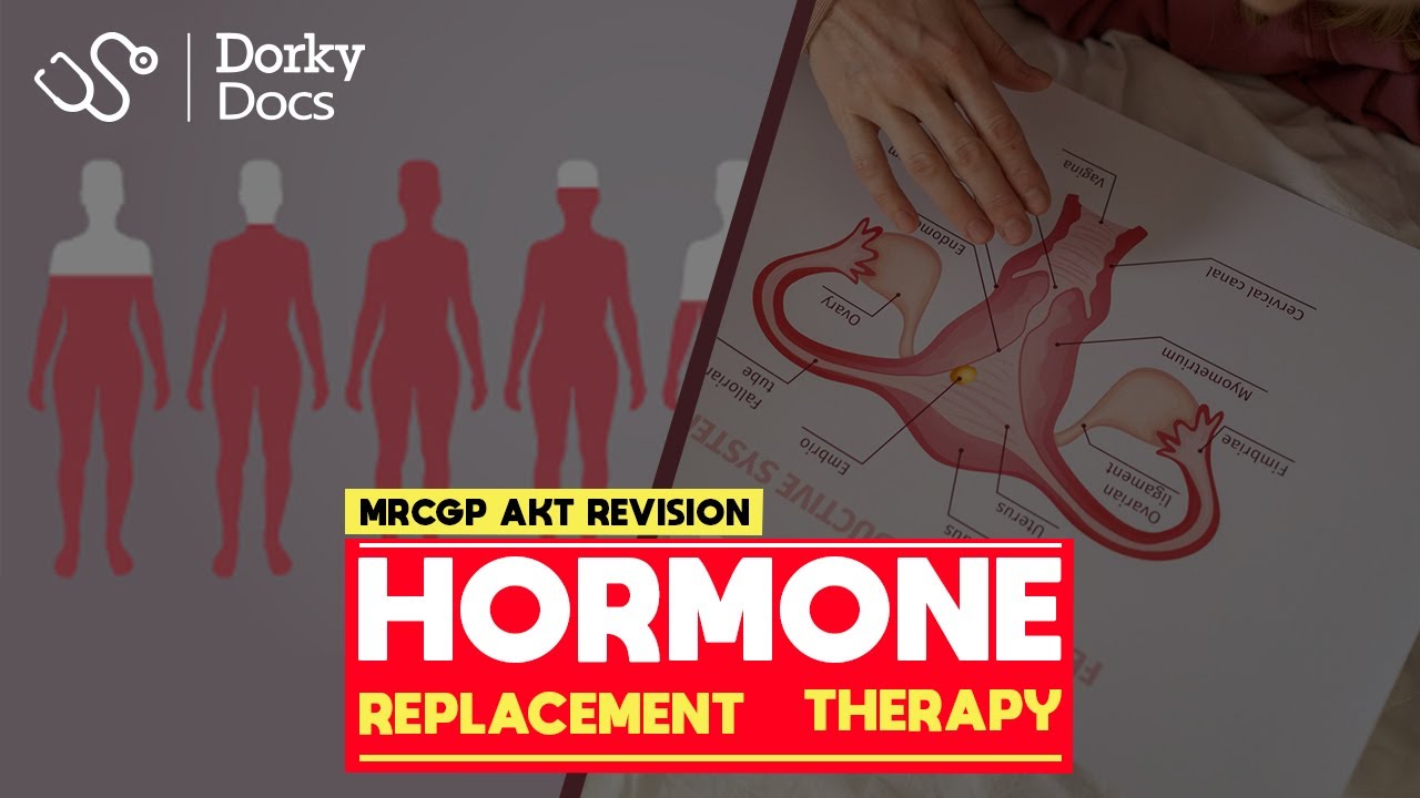 Hormone Replacement Therapy (HRT) - The MRCGP AKT Revision I Dorky Docs