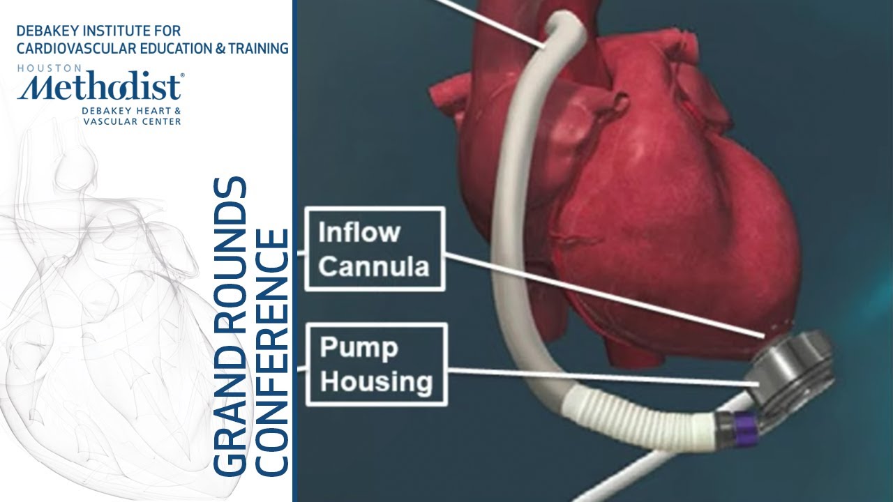 Cardiology Fellows' Presentations (Paul Karagiannis, MD and Maan Malahfji, MD) May 9, 2019