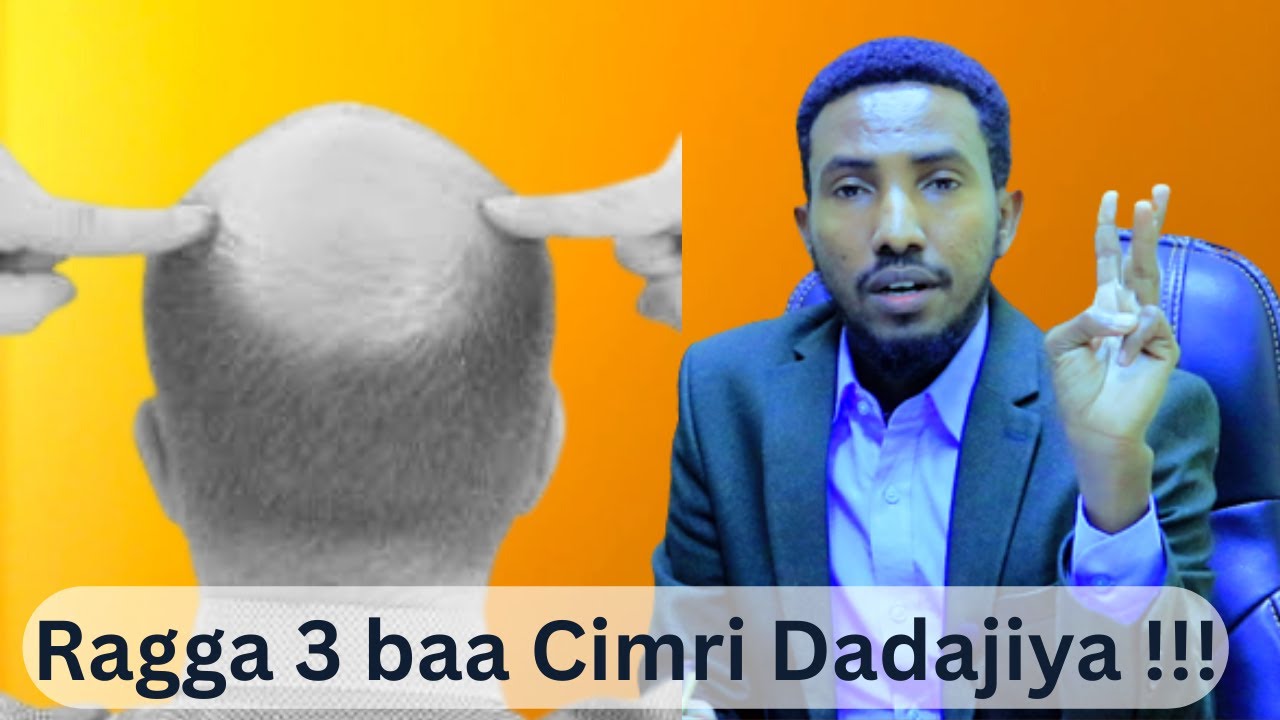 Raggu 3 wuu ku cimri degdegaa !! Saddexna wuu ku halaagsamaa !!@Nagaadtv