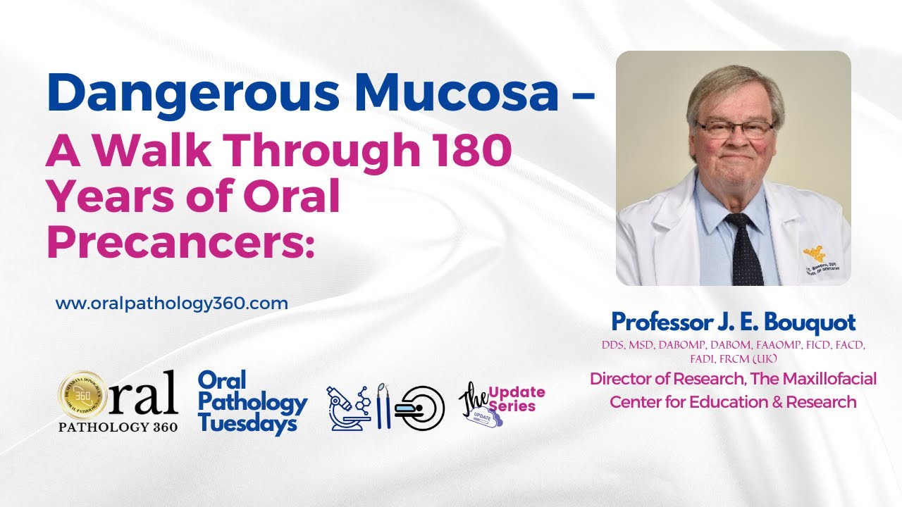 Dangerous Mucosa &ndash; A Walk Through 180 Years of Oral Precancers | Beyond Borders| Oral Pathology360