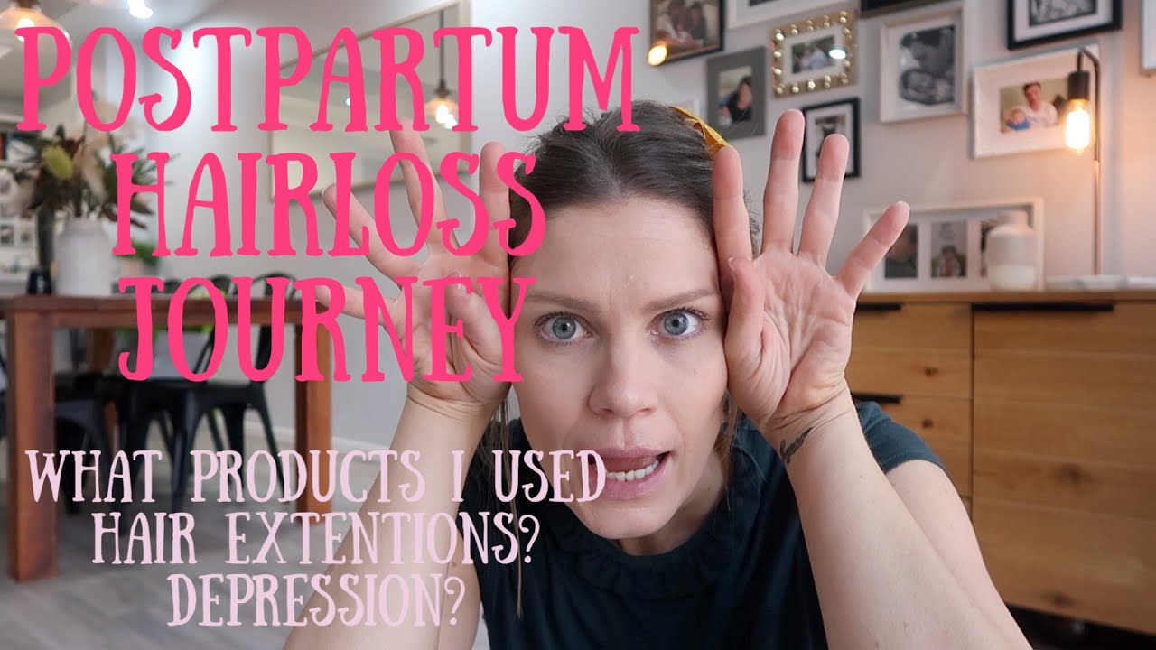 Postpartum hairloss | MY HAIRLOSS JOURNEY POSTPARTUM