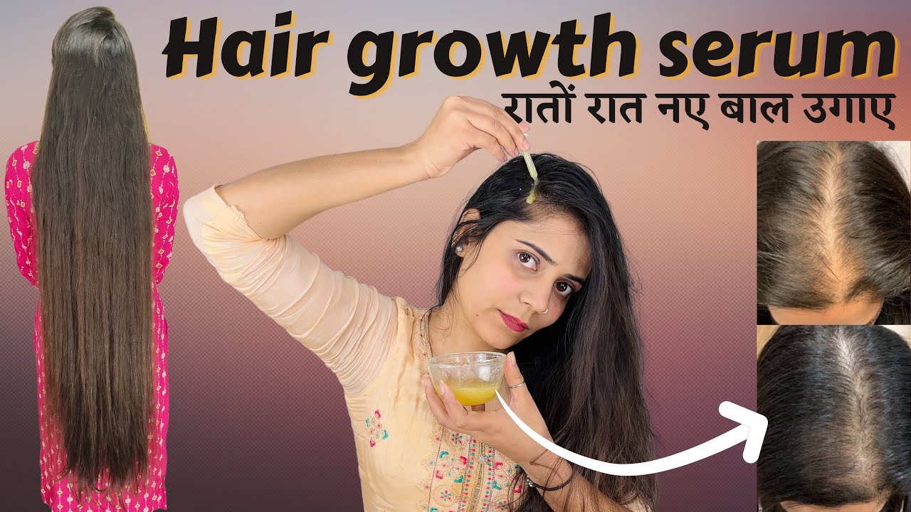 Overnight Hair Growth Serum | रातों रात नए बाल उगाए | hair regrowth serum #thesoni #haircare #hair