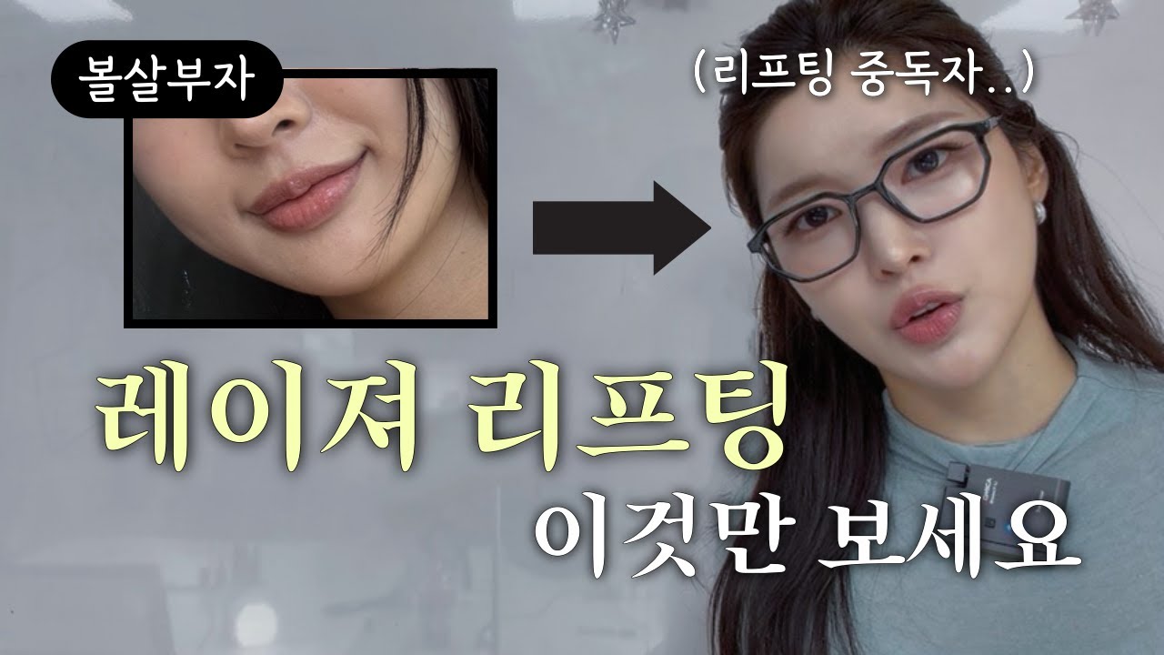 리프팅 레이저 고민 그만하세요🤦🔥나에게 딱맞는 리프팅시술 고르는법 (레이저리프팅/티타늄/울쎄라/써마지/튠페이스/슈링크/인모드/볼살없애는법/쳐진살올리는법/얼굴형관리/브이라인)