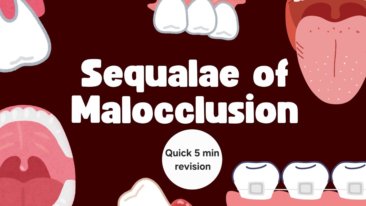 Sequelae of Malocclusion | Quick 5-Minute Orthodontics Revision