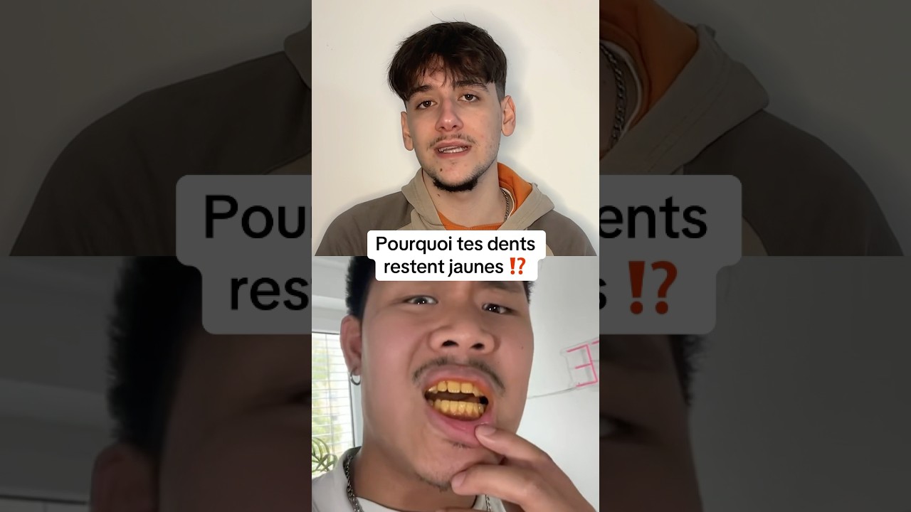Pourquoi tes dents restent jaunes ‼️ #tips #dents #glowup