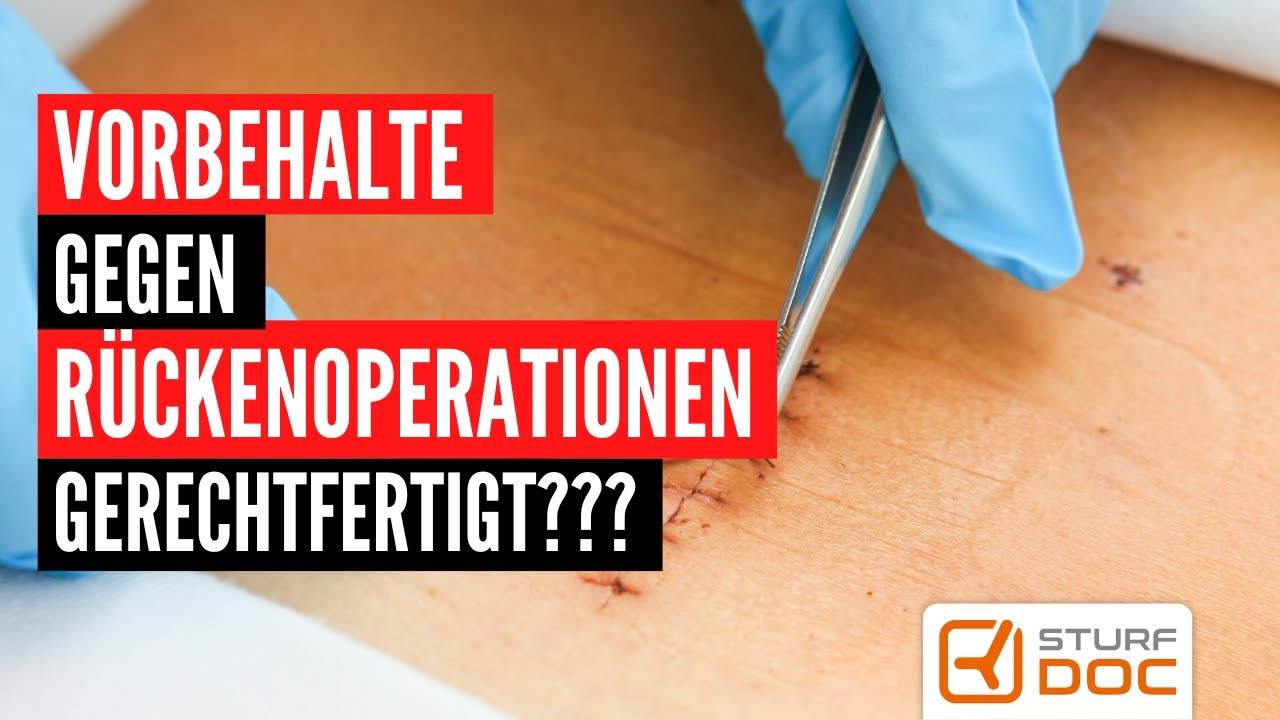 Vorbehalte gegen Wirbels&auml;ulenoperationen gerechtfertigt?