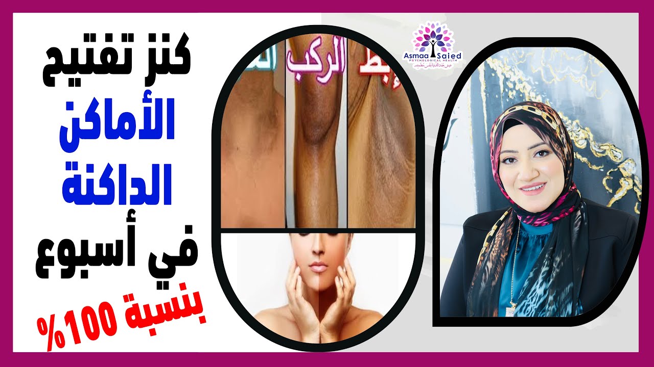 عرفت أفتح الأماكن الداكنة بهذه الوصفة (في أسبوع فقط )