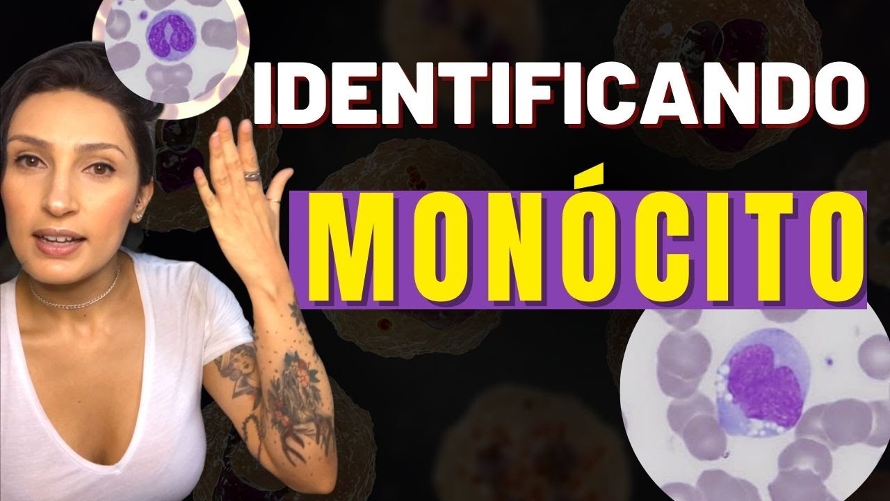 Como Identificar o Monócito - Leucocito agranular - Linfócito atípico - Bastonete - não confunda