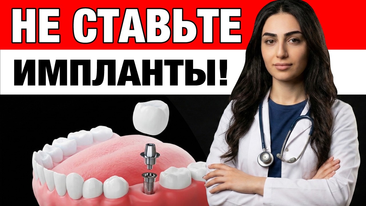 Почему после 50 НЕЛЬЗЯ импланты. Стоматологи молчат об этом!