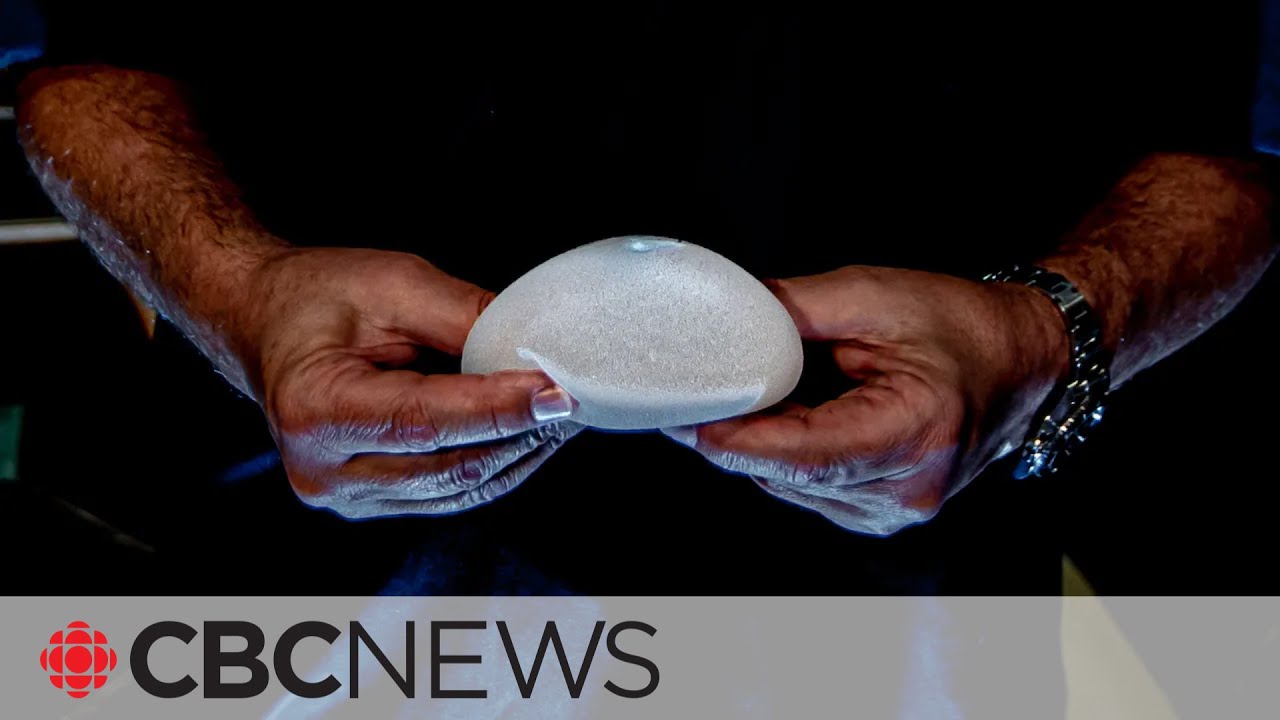 Thousands of suspected injuries tied to breast implants, CBC analysis finds