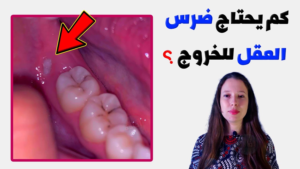 كم يوم يحتاج ضرس العقل للخروج؟
