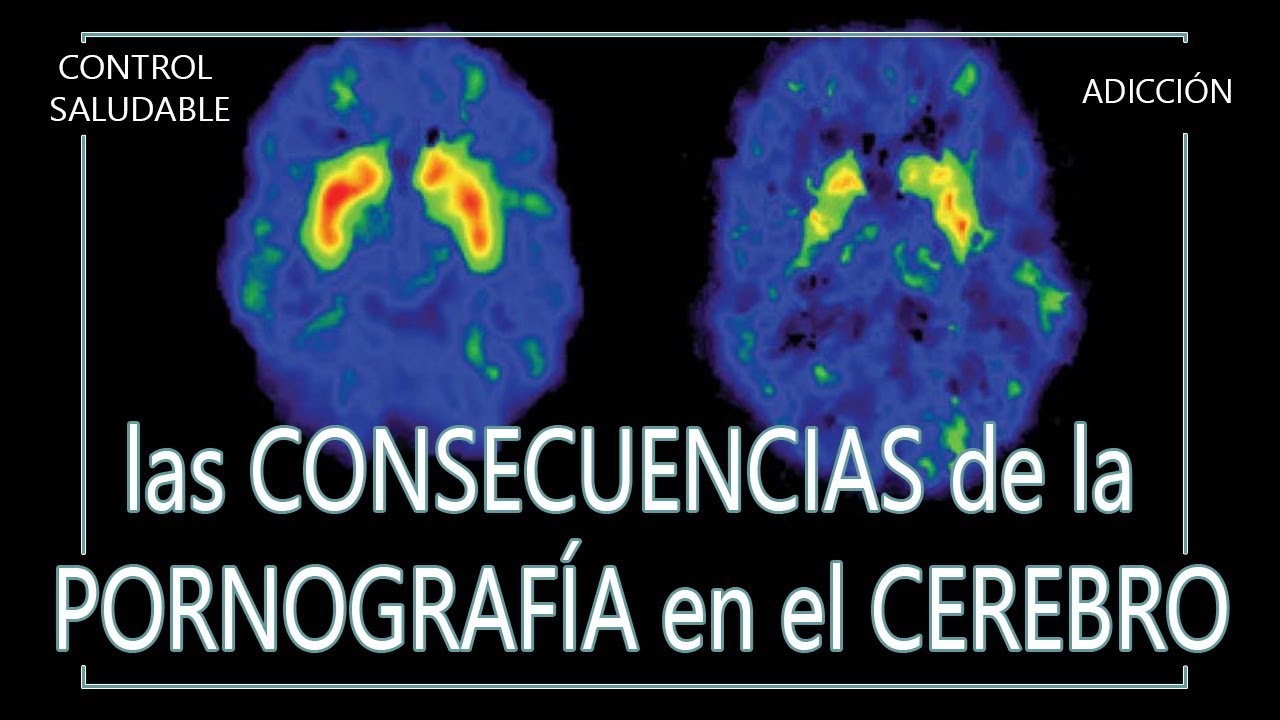 Las CONSECUENCIAS de la Pornografía en el CEREBRO