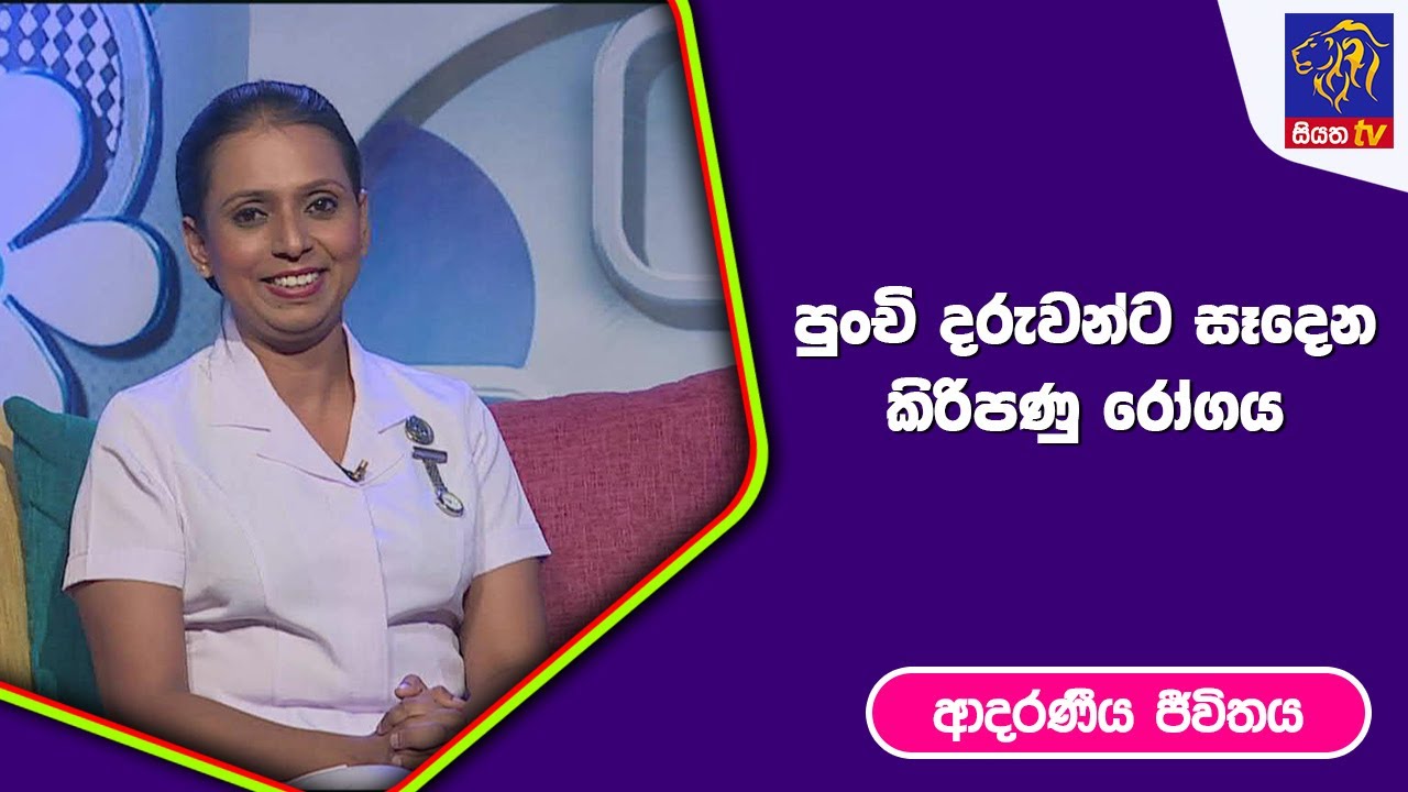 පුංචි දරුවන්ට සෑදෙන කිරිපණු රෝගය | ආදරණීය ජීවිතය | 24 - 04 - 2023