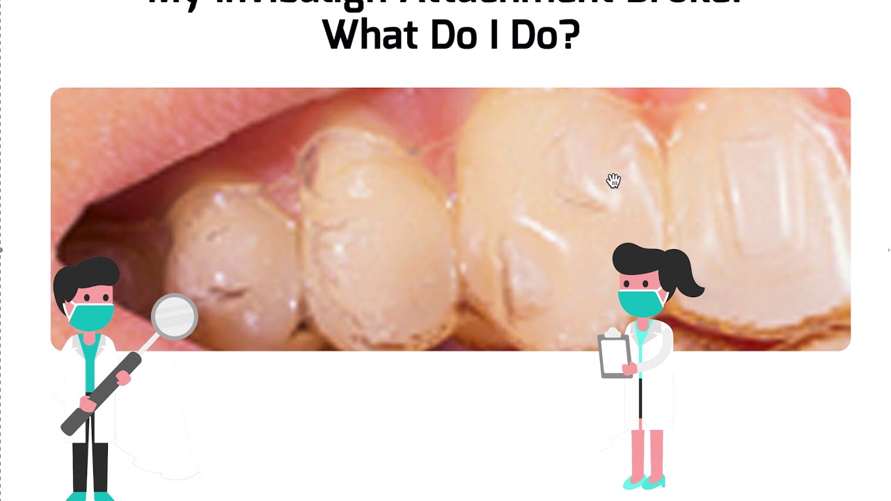 Attachment Breakage-  Invisalign, ClearCorrect or Aligner