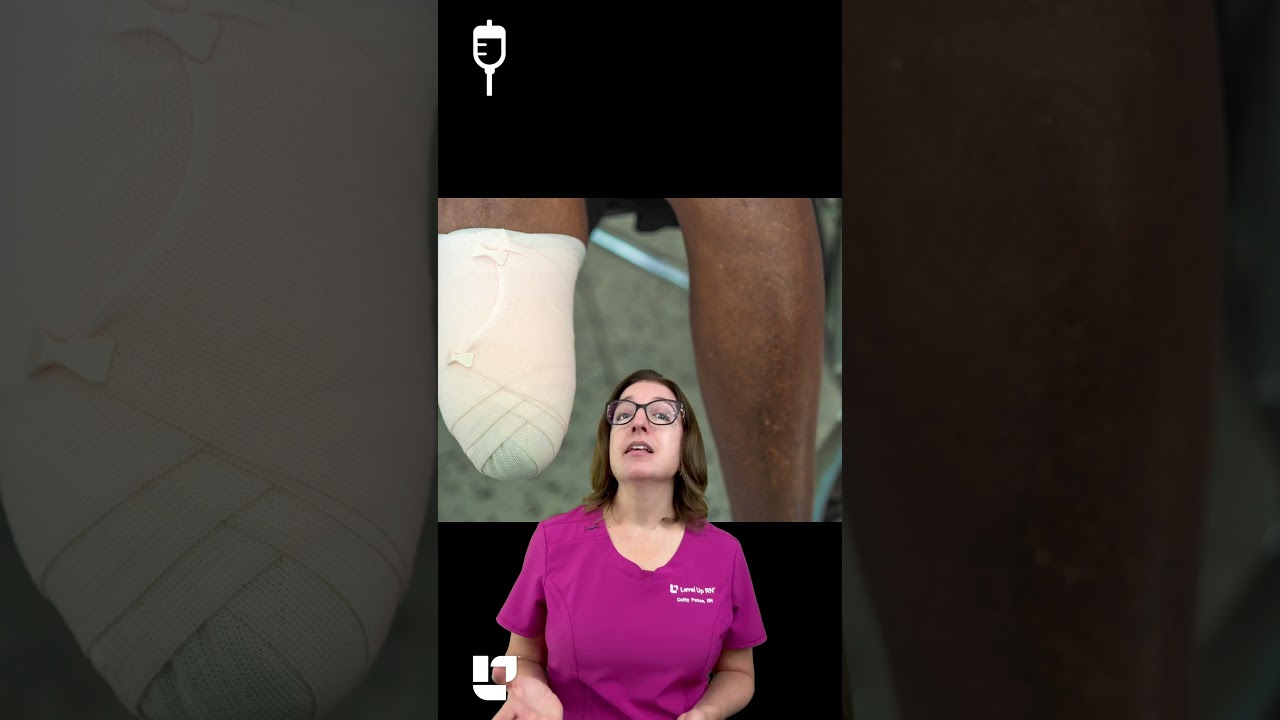 Nursing care of patient after amputation: Medical Surgical SHORT | @LevelUpRN