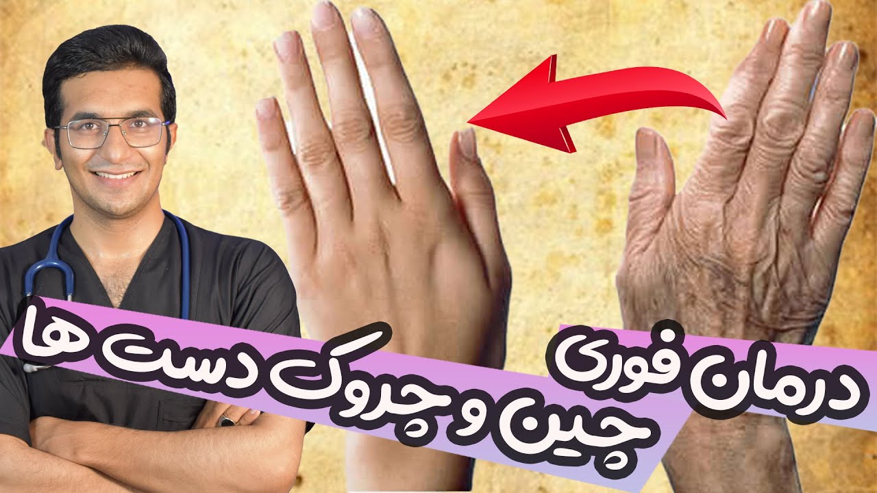 Remove Wrinkles from Hands | درمان فوری چین و چروک پوست دست