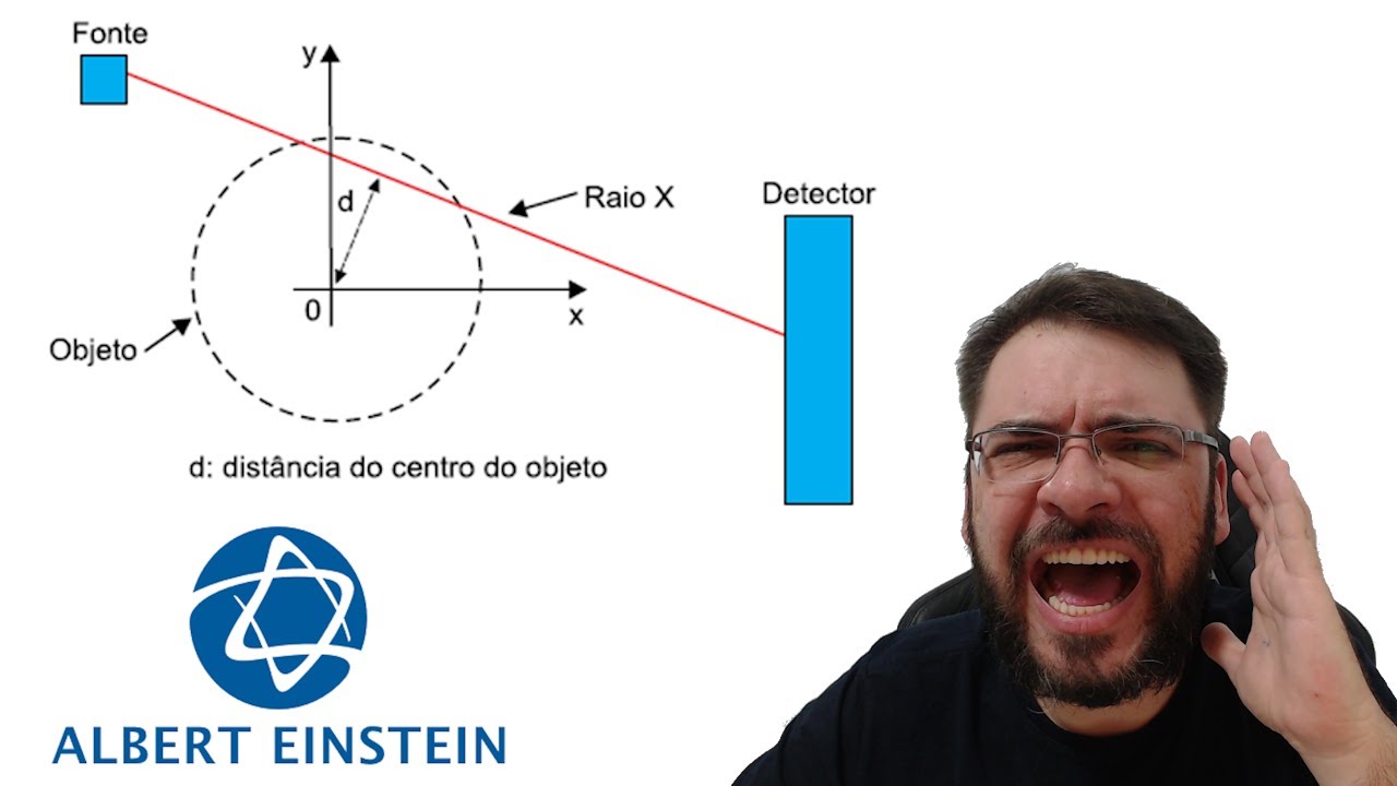 EINSTEIN/2020 O esquema a seguir é uma representação simplificada de um raio X usado em um aparelho