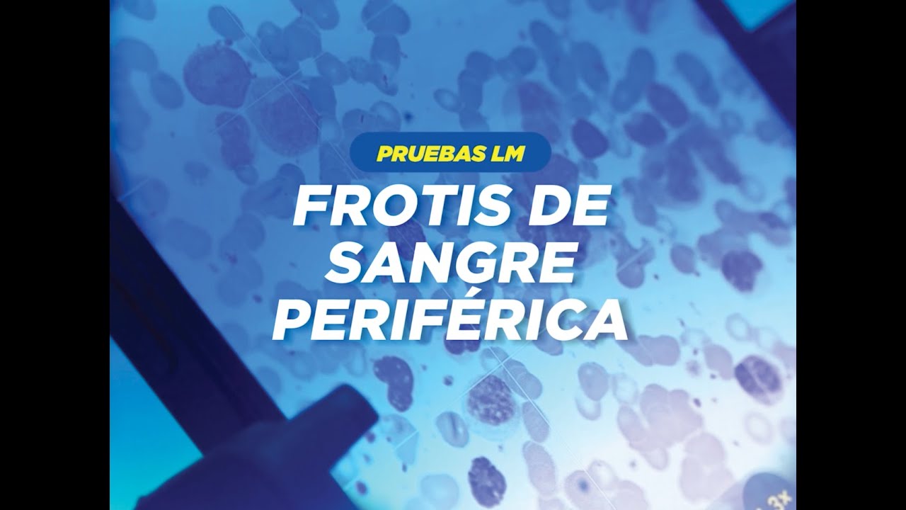 El Frotis de Sangre Perif&eacute;rica