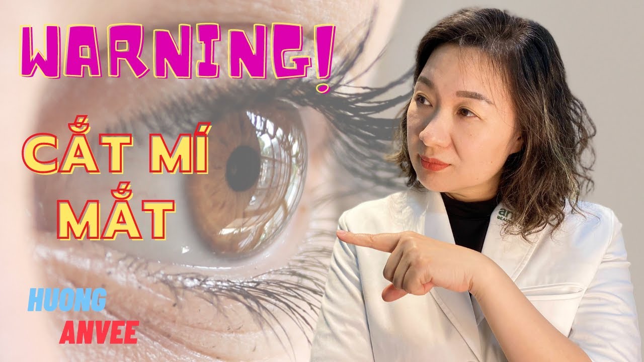 Cắt mí mắt bị trợn , bị hở khe mi và những nguyên nhân cần biết I Huong Anvee Official