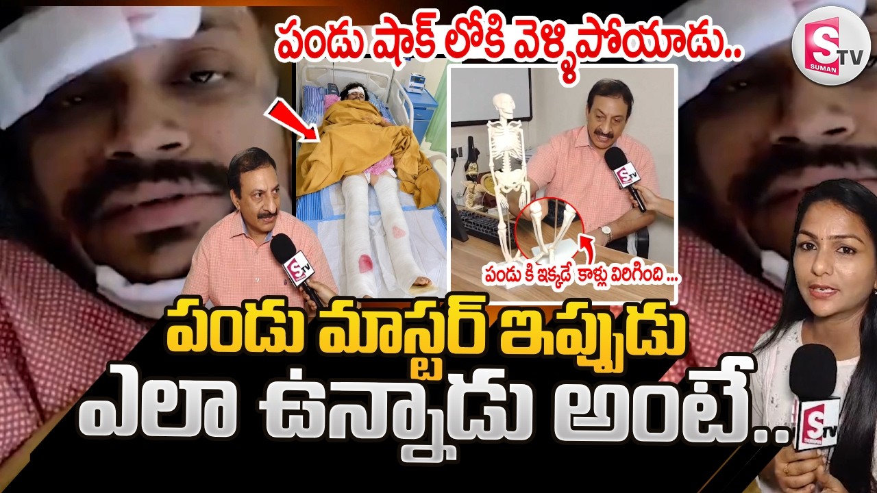 ఇక్కడే  కాళ్లు విరిగింది..Pandu Master Health Update | Pandu Master Road Accident | Dhee Pandu
