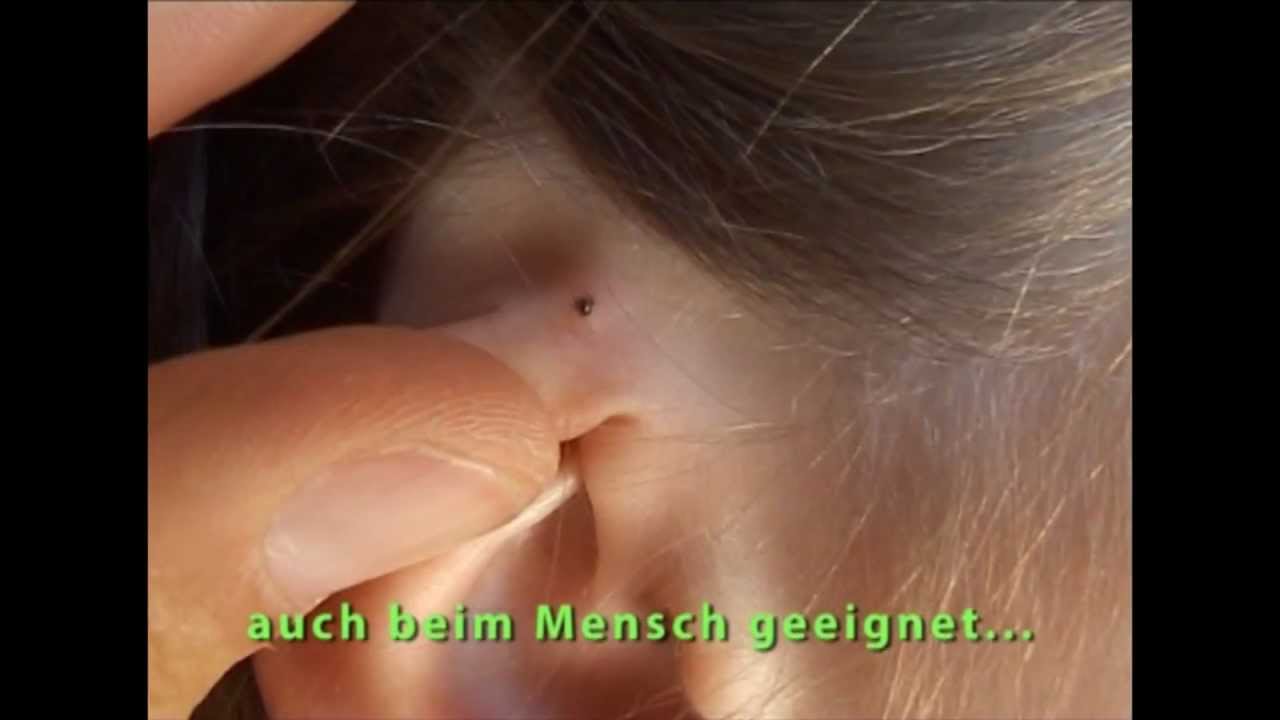 Zeckenhaken Anwendungsbeispiele Original Kozbach OTOM TICK TWISTER HOOKS