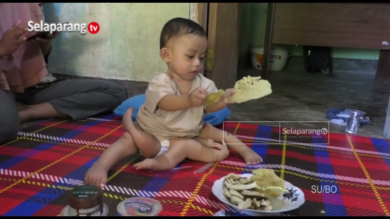BAYI KEMBAR SIAM DI SUWANGI TIMUR SEGERA JALANI OPERASI PEMISAHAN