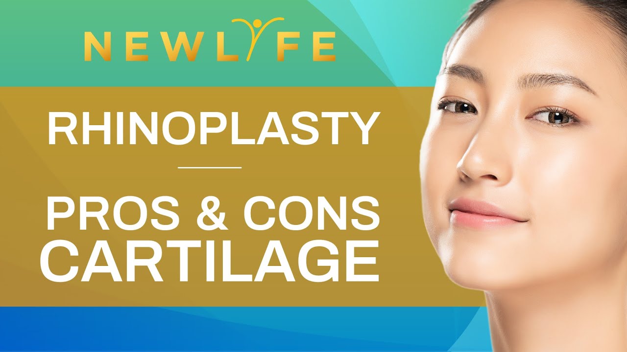 PROS and CONS of CARTILAGE (Rhinoplasty)