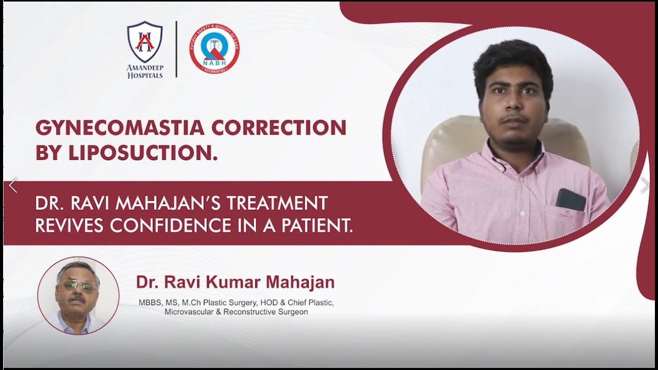Gynecomastia Correction By Liposuction | AMANDEEP HOSPITAL