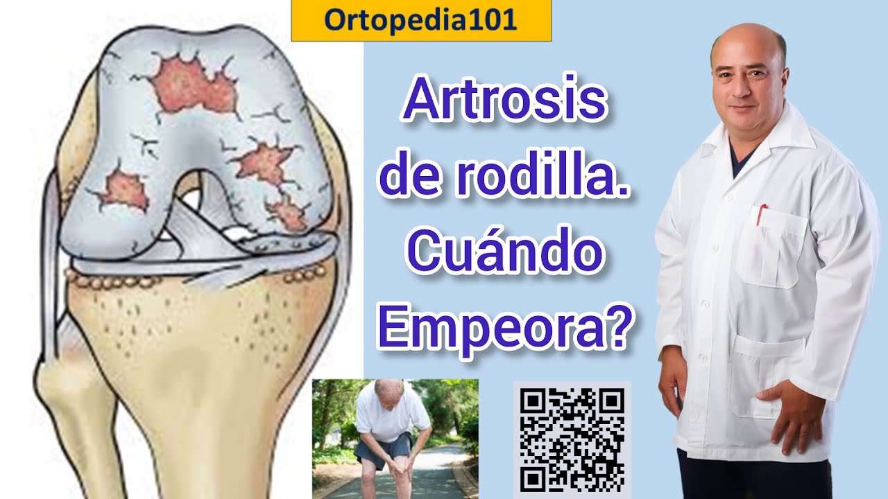 Artrosis de rodilla  ¿Cuándo empeora?