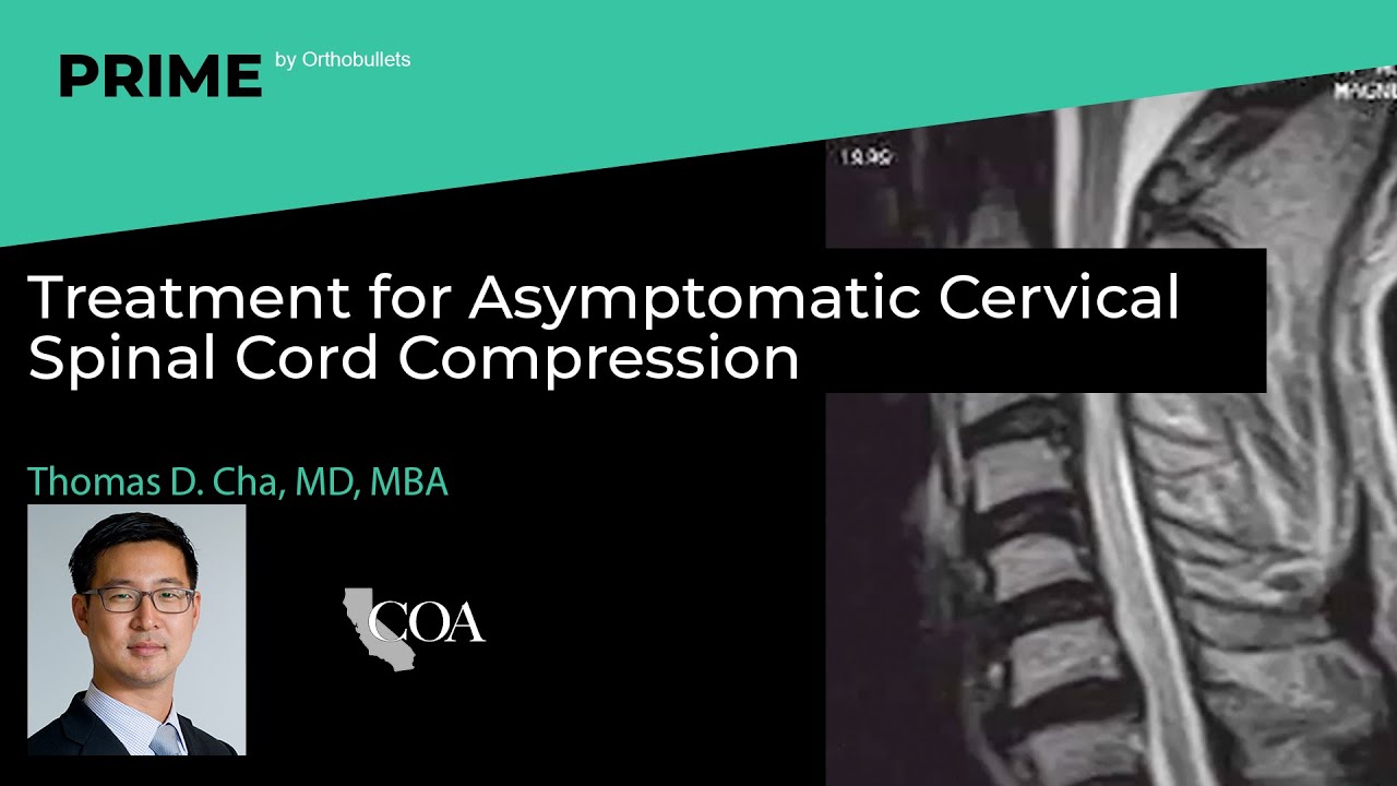 Treatment for Asymptomatic Cervical Spinal Cord Compression - Thomas D. Cha, MD, MBA